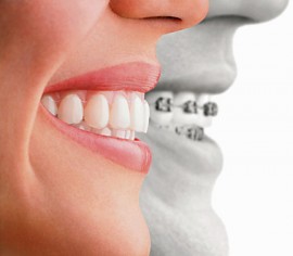 Orthodontist Dentist Gainesville